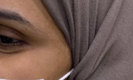 بعد علاج البشرة في مجمع أيار السابع الطبي جازان